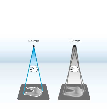 ProVecta HD - Intra-oral X-ray Generator - smallest focal spot