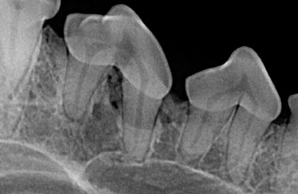 ScanX Duo - Computed Radiography system - Handles image plate size 6 - The only unit in market