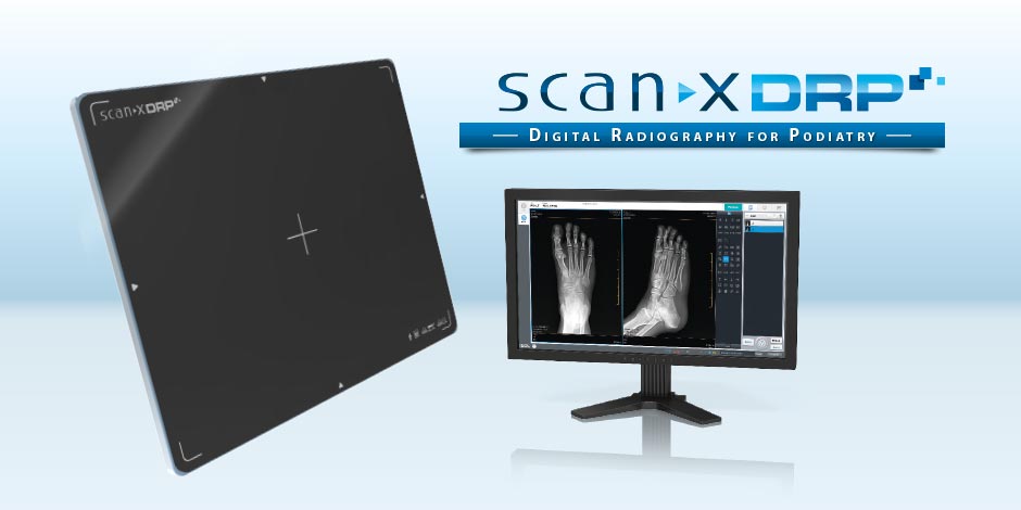 ScanX DRP - Digital Radiography for Podiatry